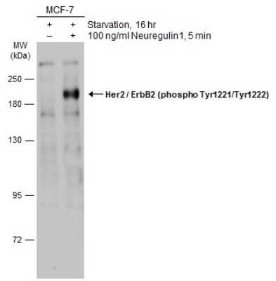 Western Blot: ErbB2/Her2 [p Tyr1222, p Tyr1221] Antibody [NBP3-13232]